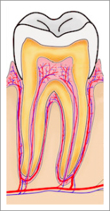 Cure Dentali Devitalizzazione